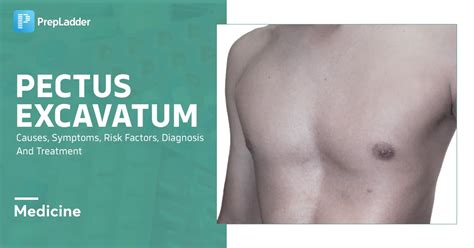 Pectus Excavatum: Symptoms, Treatments, and Complications - Health…