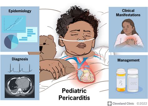 Pediatric Pericarditis: Update - PubMed