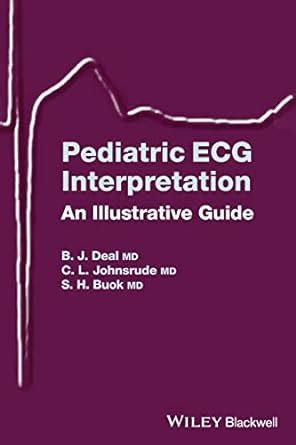Pediatric ecg interpretation an illustrated guide. - The can do guide ingredients to success accompanying powerpoint presentations accompanying powerpoint presentations.