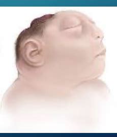 Pediatric neurological disorders quizlet.  Question content of these nursin...