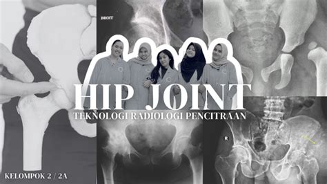 Pemeriksaan Klinis Osteoarthritis Tibiofemoral Joint