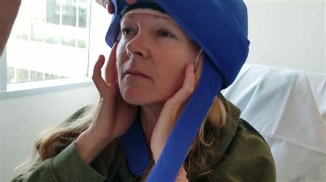 Penguin cold caps. The aim of this registry study was to assess efficacy and tolerability of scalp hypothermia using Penguin Cold Caps (Penguin) in breast cancer patients. Methods: Hair loss was assessed by patients using a 100-point Visual Analog Scale (VAS) and by physicians using the 5-point Dean Scale at baseline, every 3-4 weeks during chemotherapy, and at ... 
