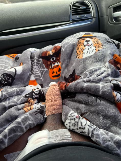 Penuma surgery before and after reddit.  Click any image to view it larger.  5 we...