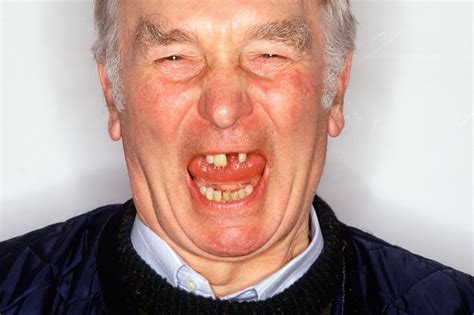 People with ugly teeth. The wealthy used to only be able to afford sugar and having bad teeth was a sign of wealth. Bad teeth were once a sign of wealth, says Scott-Dearing. “The teeth of the very wealthy were typically horrifically bad at a time when access to sugar was an extreme privilege. The royal court had the worst teeth going.”. 
