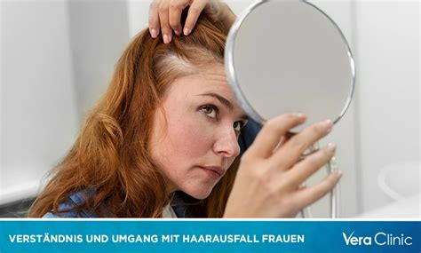 Perücken für Frauen mit Haarausfall: Ihr Leitfaden zu Schönheit, Selbstvertrauen und Wohlbefinden