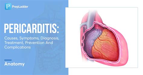 Pericarditis - Symptoms, diagnosis and treatment - BMJ