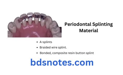 Periodontal splints: Past to present: A review Blessyphilip P G ...