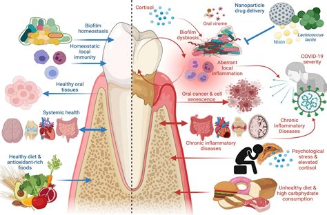 Download Periodontal Disorders E Chart Full Illustrated By Hchealthcomm