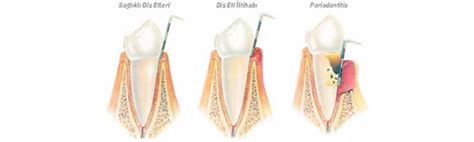 Periodontoloji Ortonorm.