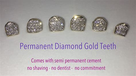 Permanent Diamond Teeth Price