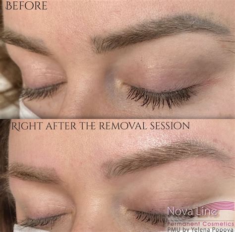 Permanent makeup removal.  It implies a lack of temporary or transient qualities and sugg...