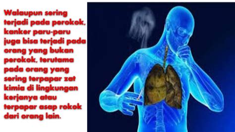 Perut dan dada sakit saat batuk. Apa penyebabnya? Tanya Dokter …