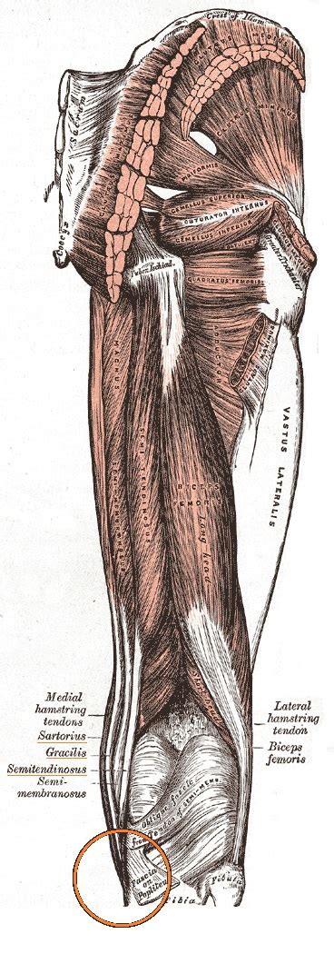 Pes anserinus bursitis - Physiopedia