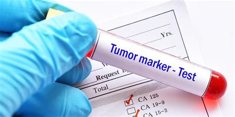 Petanda Tumor (Tumor Markers) Dan Tes ... - kumparan