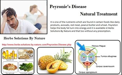 Peyronie apos s disease natural treatments and cures. - Guide to sport crags in southern california.