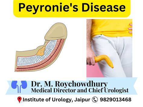 Peyronies sjukdom operation