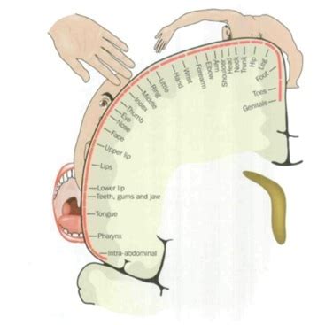 Phantom Limb Pain - Physiopedia