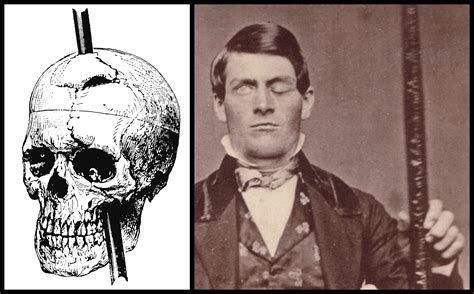 Phineas Gage A Gruesome but True Story About Brain Science