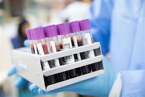 Phlebotomy jobs without experience. Non Certified Phlebotomist. CHI St Alexius Bismarck. Bismarck, ND 58501. $16.29 - $21.79 an hour. Part-time. On call. Uses learned skills to properly identify patients, efficiently collect samples and properly identify specimens for laboratory testing, including non-blood…. Posted 7 days ago ·. 