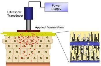 Phonophoresis: efficiency, mechanisms and skin tolerance