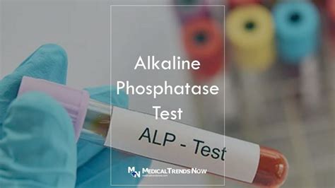 Phosphatasetest – Wikipedia