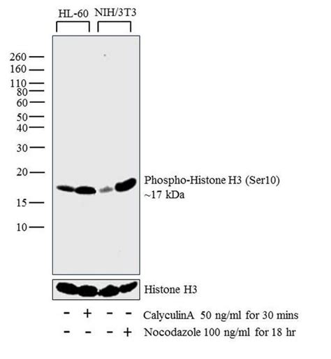 Phospho-Histone H3 (Ser10) Antibody (PA5-17869)