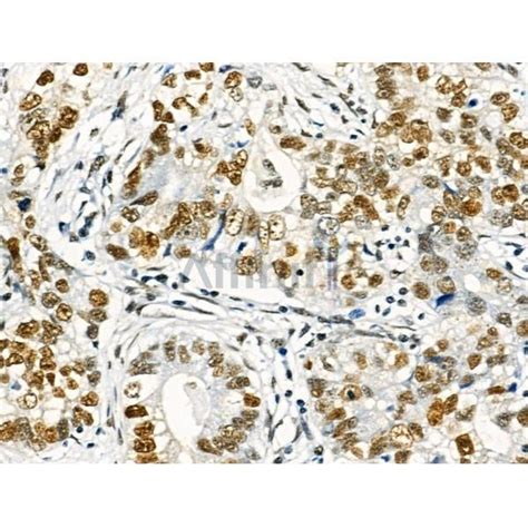 Phospho-NFAT2 (Ser172) Antibody Affinity Biosciences