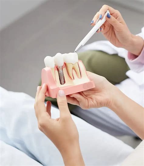 Photogrammetry image set.  Serving Bay Area implant dentists.  So I though sometimes...