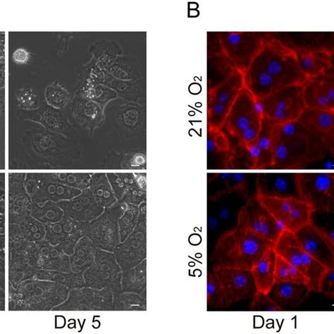 Physiological oxygen tension reduces hepatocyte dedifferentiation …