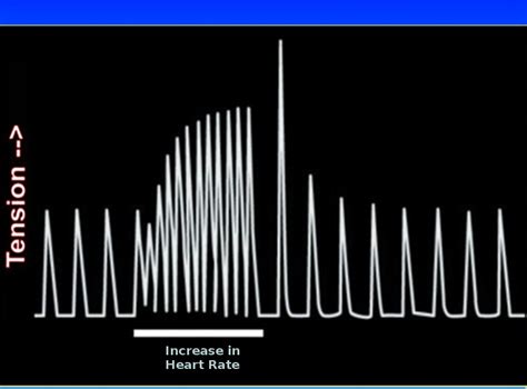 Physiology, Bohr Effect - StatPearls - NCBI Bookshelf