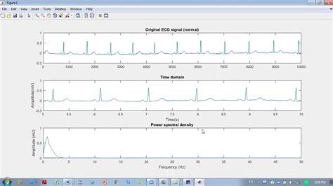 Physionet ecg database matlab. ) The ECG-ID Database is a set of 310 ECGs ...