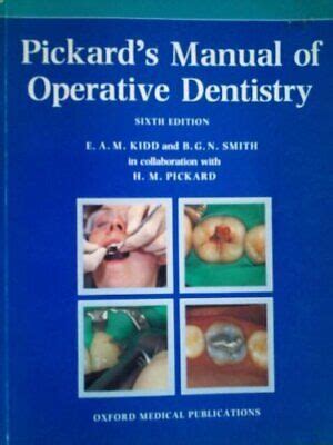 Pickard s manual of operative dentistry. - The seismic analysis code a primer and users guide.