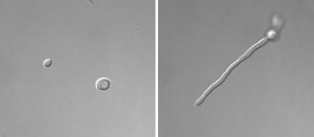 Picture of Candida thread... at Candida & Dysbiosis Forum, topic 290724