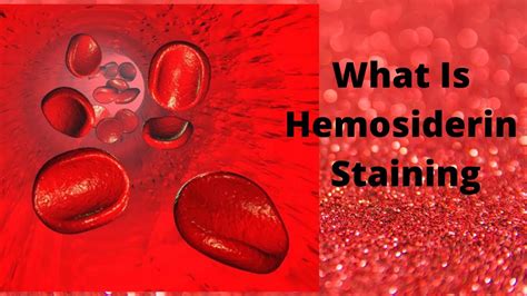 Pictures Of Hemosiderin Staining