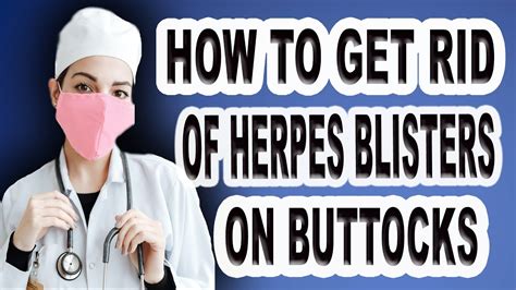 Pictures of Herpes on Buttocks - Why You Need to Be Prepared …