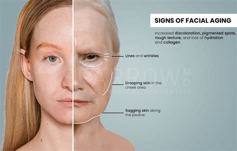 Pictures of facial effects of fae.  David Smith in Seattle, Washington, USA.  Fin...