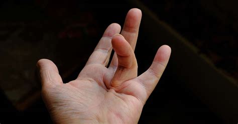 Pictures of vikings disease. .  January 18, 2026 answer of Setups For Some Elaborate G...