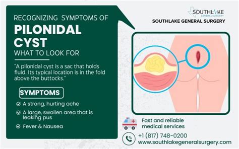 Pilonidal cyst reddit popping.  Learn how Pilonidal Disease is diagnosed.  Learn symptoms, ...