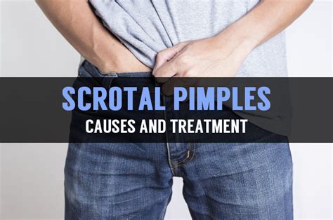 Pimples on the scrotum usually result from dead skin, bacterial clogs, ingrown hair, or sexually transmitted infections. They are itchy and harmless in some. Consult a doctor. Ask a doctor online. Post a health query and get an answer in minutes. Chat with a doctor. Unlimited chat with a doctor