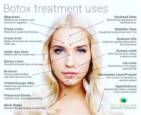 Pin by Laura Buchanan on Work Facebook page Botox face, Botox, Botox