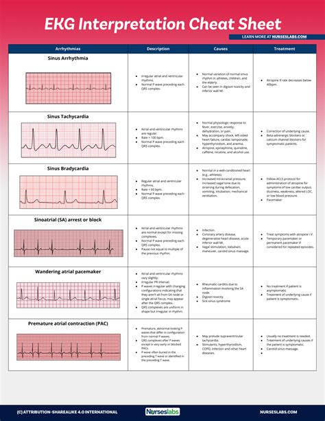 Pin on Ekg interpretation cheat sheets