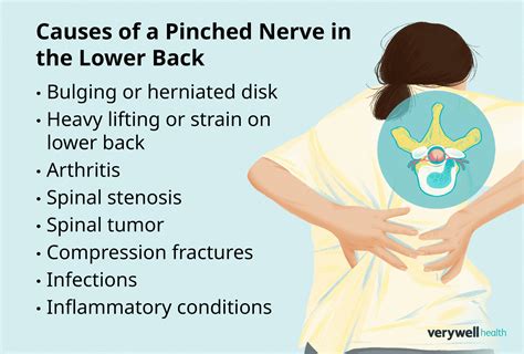 Pinched nerve in lower back How to tell and more