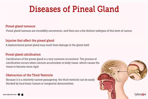 Pineal Gland (Human Anatomy): Image, Function, Diseases, and …