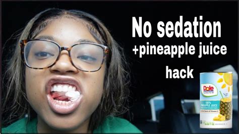 Drink Pineapple Juice Before Wisdom Teeth Reddit. However, the 