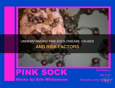 Pink Sock Onlyfans Leak