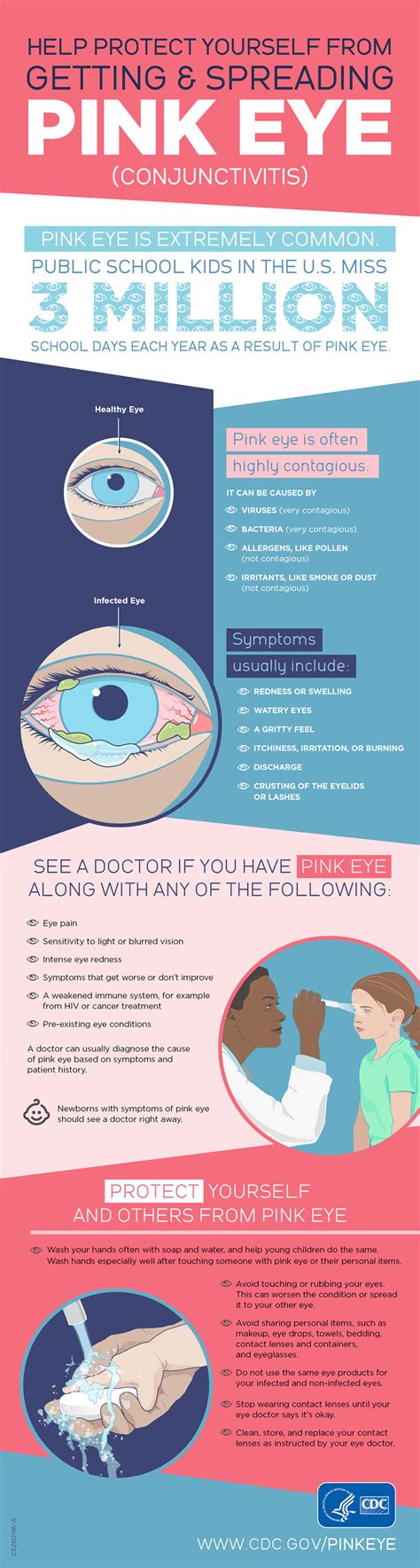 Pink-Eye (Conjunctivitis) Personal Health - livgov.com