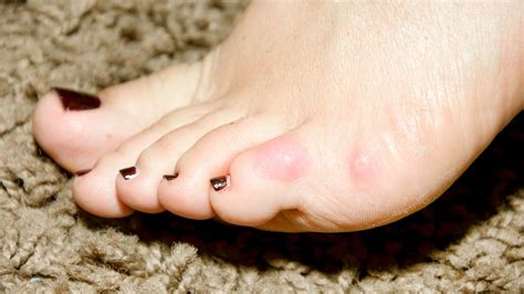 Pinkys_Toes Onlyfans Leaked 🍌 +18