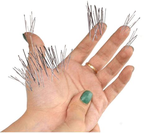Pins and needles in hands after exercise
