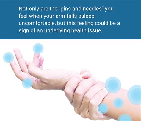 Pins and needles in hands while sleeping