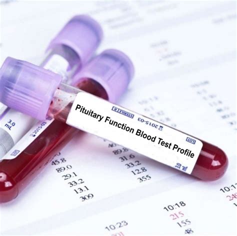 Pituitary Function Blood Test Profile Blood Tests in London